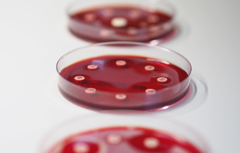 Petrischalen mit Versuchen