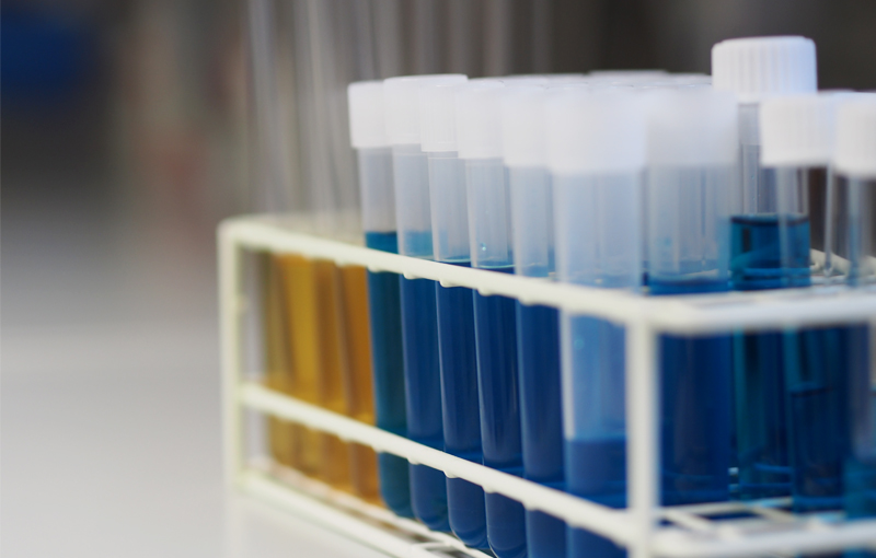 Reagenzgläser mit verschiedenen Füllungen